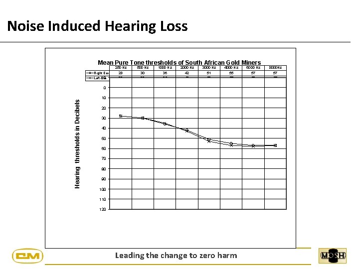 Noise Induced Hearing Loss Mean Pure Tone thresholds of South African Gold Miners Right