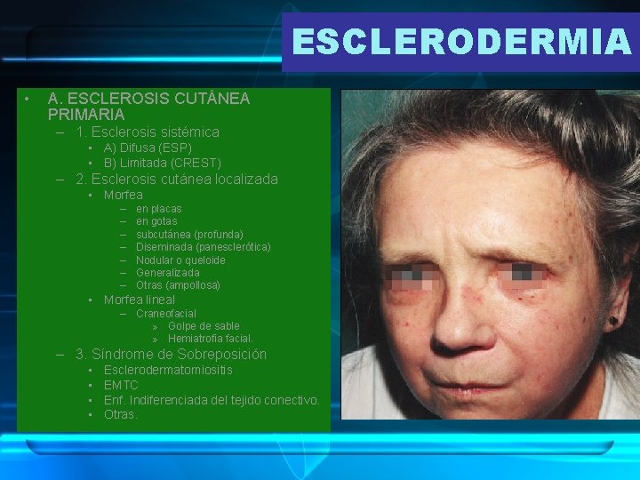 ESCLERODERMIA • A. ESCLEROSIS CUTÁNEA PRIMARIA – 1. Esclerosis sistémica • A) Difusa (ESP)