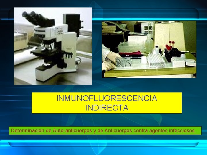 INMUNOFLUORESCENCIA INDIRECTA Determinación de Auto-anticuerpos y de Anticuerpos contra agentes infecciosos. 