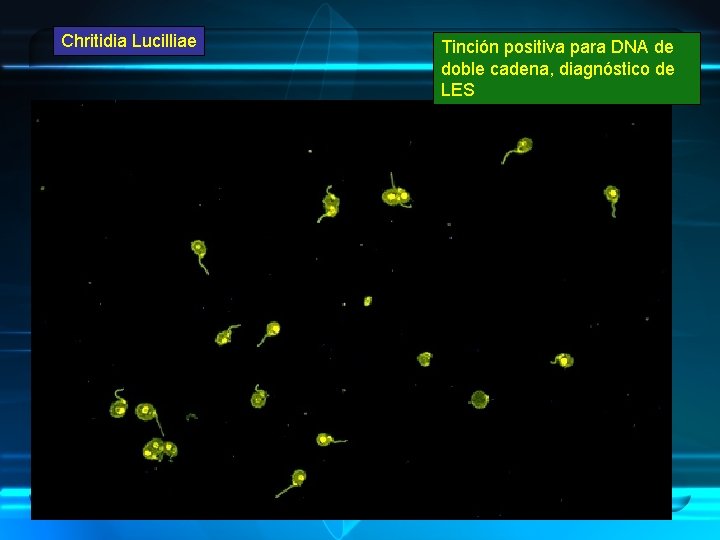 Chritidia Lucilliae Tinción positiva para DNA de doble cadena, diagnóstico de LES 