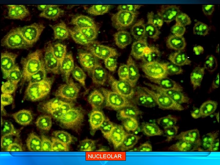 NUCLEOLAR 