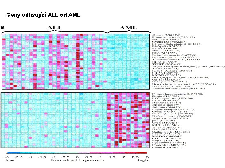 Geny odlišující ALL od AML 