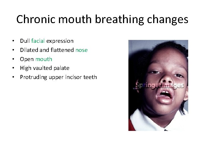 Chronic mouth breathing changes • • • Dull facial expression Dilated and flattened nose