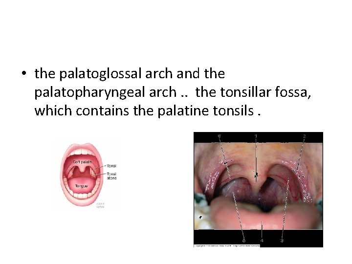  • the palatoglossal arch and the palatopharyngeal arch. . the tonsillar fossa, which