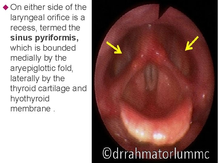  On either side of the laryngeal orifice is a recess, termed the sinus