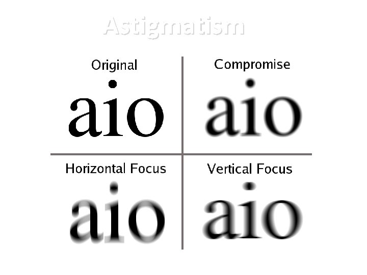 Astigmatism 