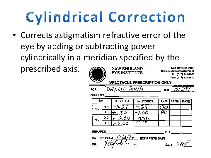  • Corrects astigmatism refractive error of the eye by adding or subtracting power