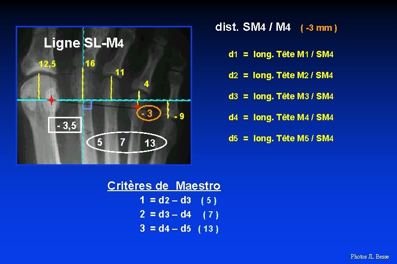 dist. SM 4 / M 4 Ligne SL-M 4 16 12, 5 ( -3