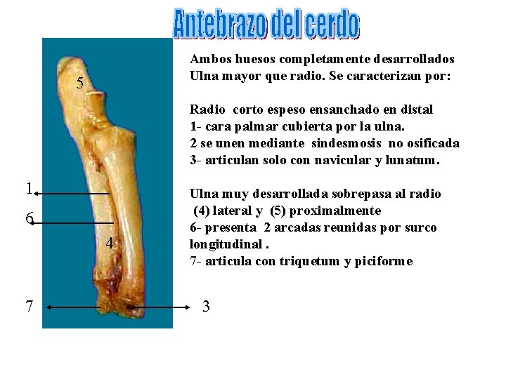 Ambos huesos completamente desarrollados Ulna mayor que radio. Se caracterizan por: 5 Radio corto