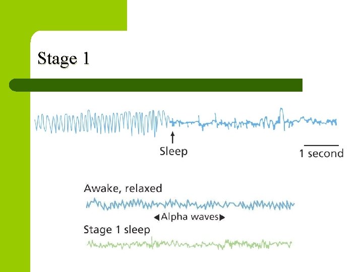 Stage 1 Stage 1