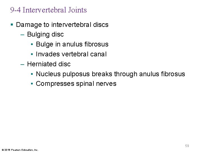 9 -4 Intervertebral Joints § Damage to intervertebral discs – Bulging disc • Bulge
