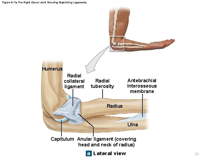 Figure 9– 7 a The Right Elbow Joint Showing Stabilizing Ligaments. Humerus Radial collateral
