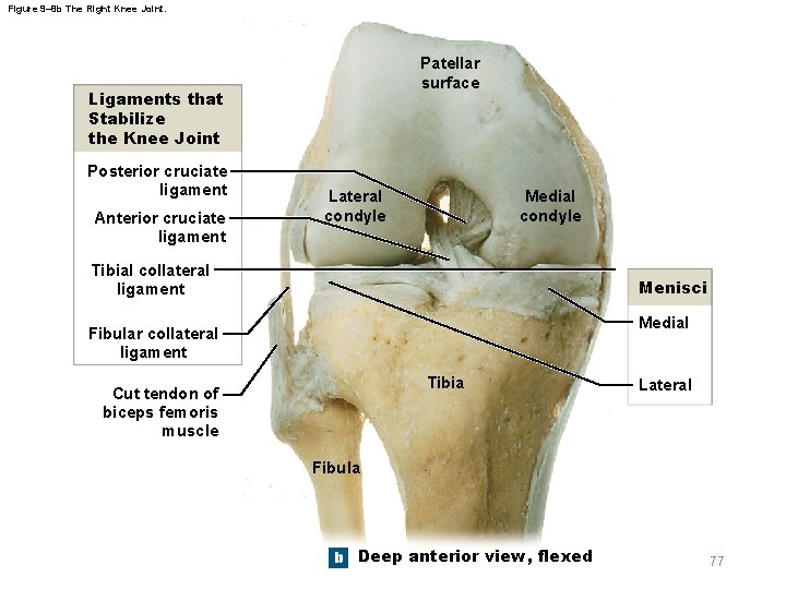 Figure 9– 8 b The Right Knee Joint. Patellar surface Ligaments that Stabilize the