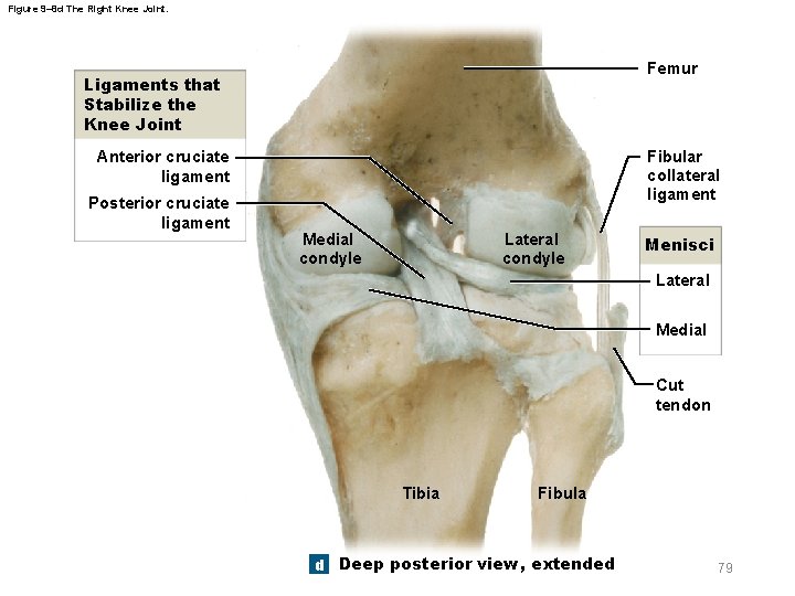 Figure 9– 8 d The Right Knee Joint. Femur Ligaments that Stabilize the Knee