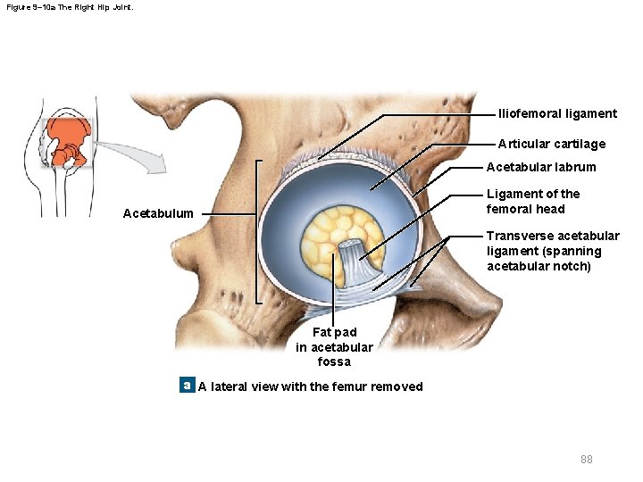 Figure 9– 10 a The Right Hip Joint. Iliofemoral ligament Articular cartilage Acetabular labrum