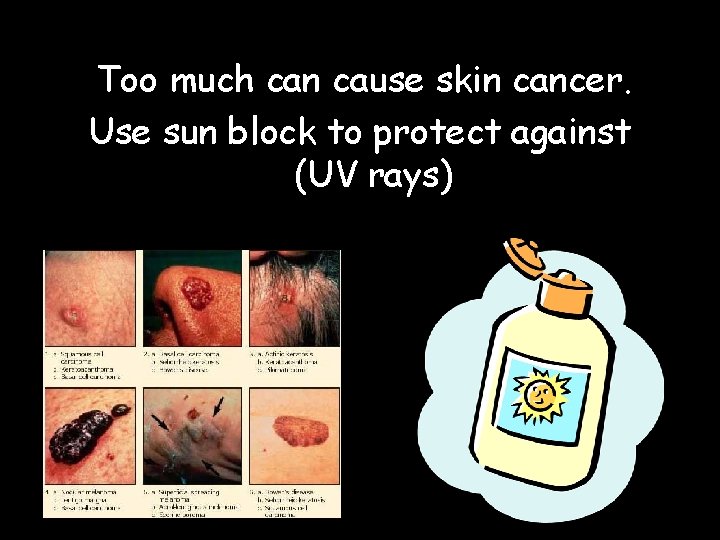 Too much can cause skin cancer. Use sun block to protect against (UV rays) Too much can cause skin cancer. Use sun block to protect against (UV rays)