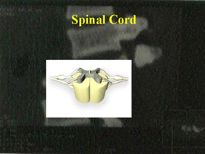 Spinal Cord 