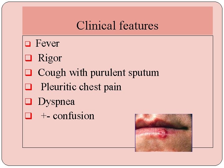 Clinical features Fever q Rigor q Cough with purulent sputum q Pleuritic chest pain