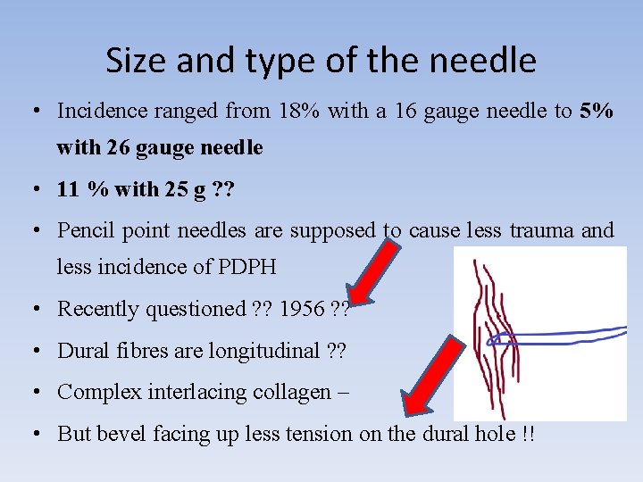 Size and type of the needle • Incidence ranged from 18% with a 16