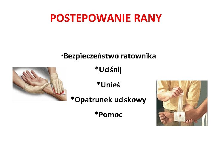 POSTEPOWANIE RANY *Bezpieczeństwo ratownika *Uciśnij *Unieś *Opatrunek uciskowy *Pomoc POSTEPOWANIE RANY *Bezpieczeństwo ratownika *Uciśnij *Unieś *Opatrunek uciskowy *Pomoc