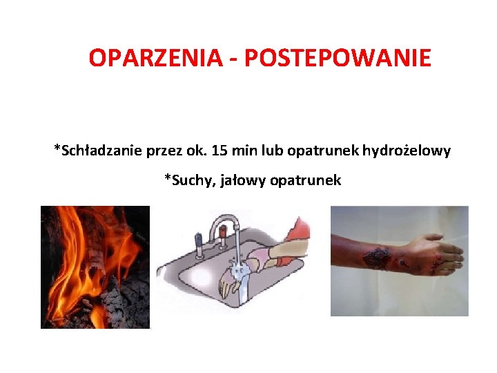 OPARZENIA - POSTEPOWANIE *Schładzanie przez ok. 15 min lub opatrunek hydrożelowy *Suchy, jałowy opatrunek OPARZENIA - POSTEPOWANIE *Schładzanie przez ok. 15 min lub opatrunek hydrożelowy *Suchy, jałowy opatrunek