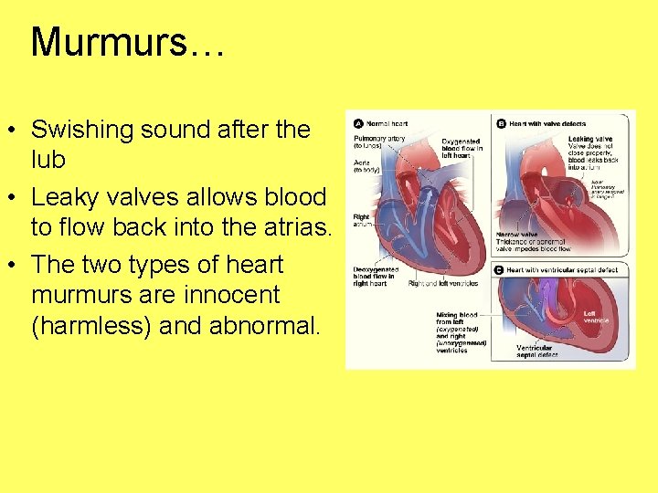 Murmurs… • Swishing sound after the lub • Leaky valves allows blood to flow