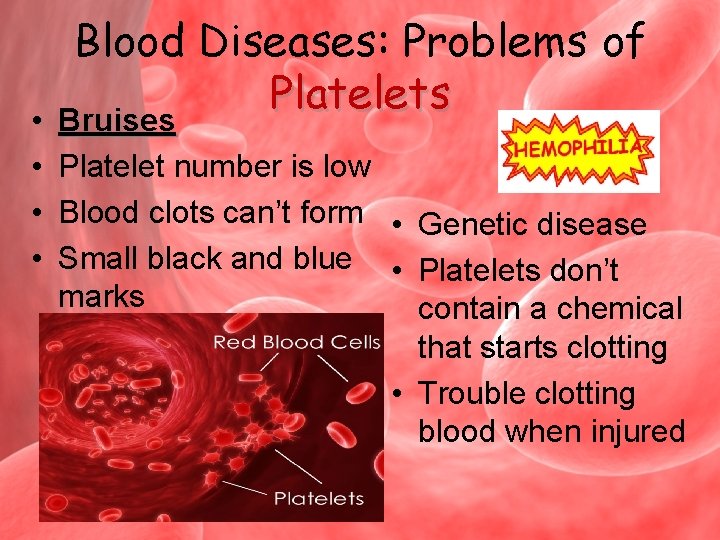 Blood Diseases: Problems of Platelets Bruises • • Platelet number is low • Blood