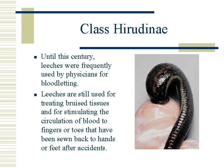 Class Hirudinae n n Until this century, leeches were frequently used by physicians for