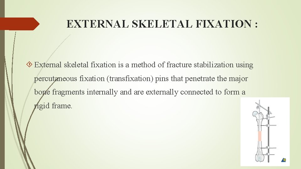 EXTERNAL SKELETAL FIXATION : External skeletal fixation is a method of fracture stabilization using