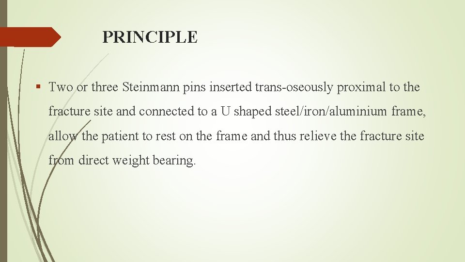 PRINCIPLE § Two or three Steinmann pins inserted trans-oseously proximal to the fracture site