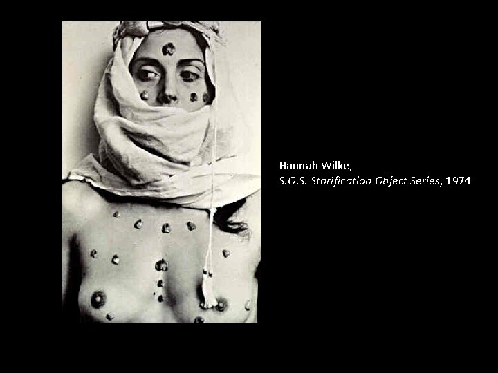Hannah Wilke, S. O. S. Starification Object Series, 1974 