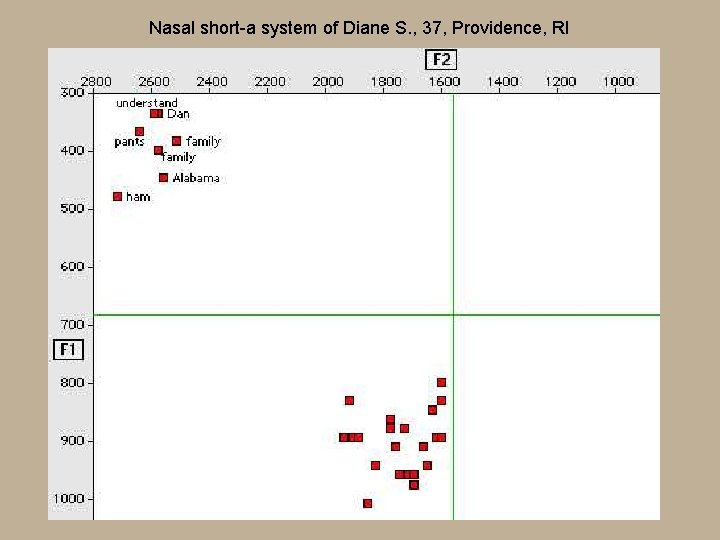 Nasal short-a system of Diane S. , 37, Providence, RI 