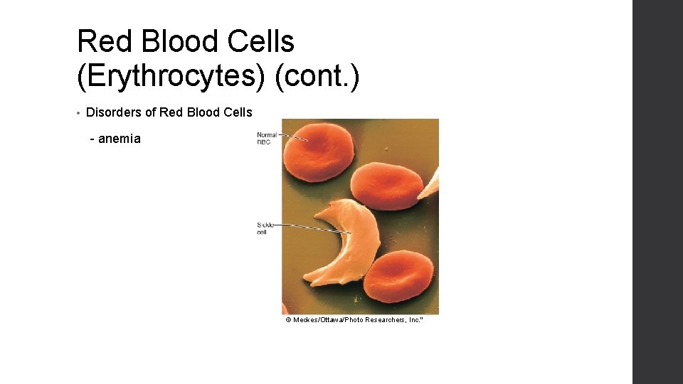 Red Blood Cells (Erythrocytes) (cont. ) • Disorders of Red Blood Cells - anemia