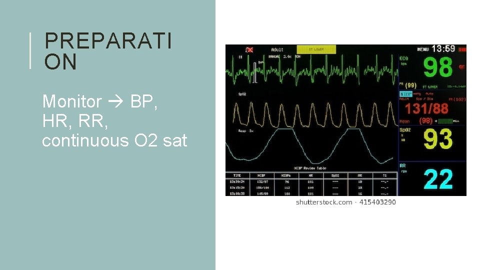 PREPARATI ON Monitor BP, HR, RR, continuous O 2 sat 