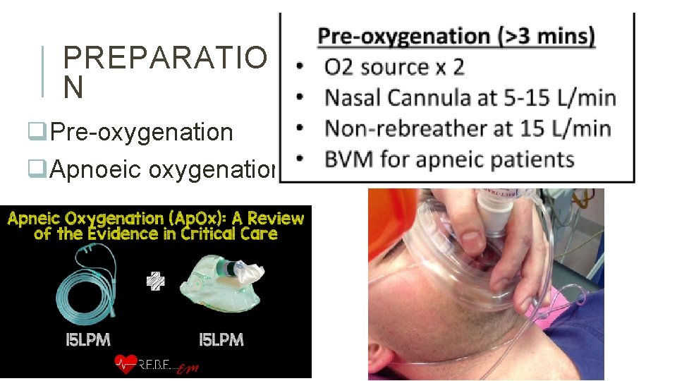 PREPARATIO N q. Pre-oxygenation q. Apnoeic oxygenation 