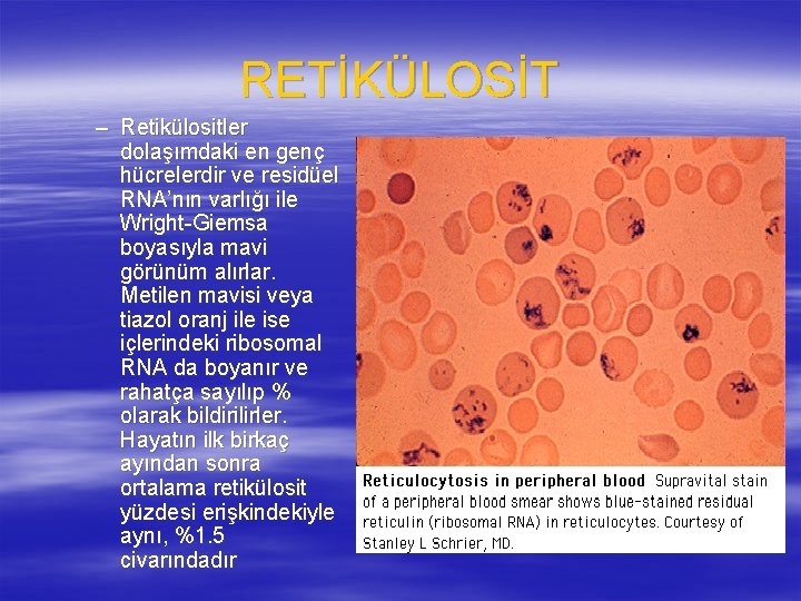 RETİKÜLOSİT – Retikülositler dolaşımdaki en genç hücrelerdir ve residüel RNA’nın varlığı ile Wright-Giemsa boyasıyla