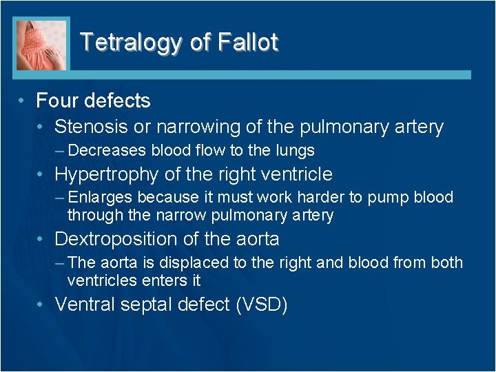 Tetralogy of Fallot • Four defects • Stenosis or narrowing of the pulmonary artery