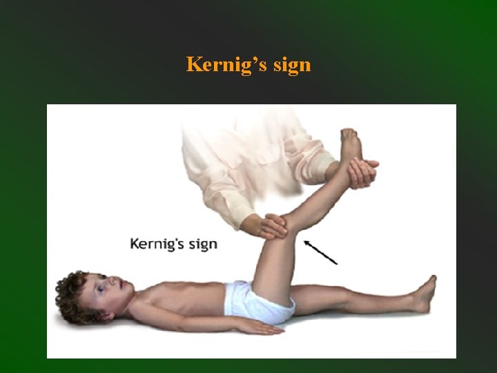 Koleiny Sign Edyta Grbczewska Central and peripheral nervous system infections
