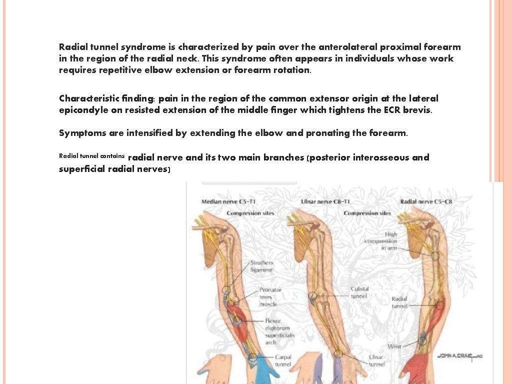 Radial tunnel syndrome is characterized by pain over the anterolateral proximal forearm in the