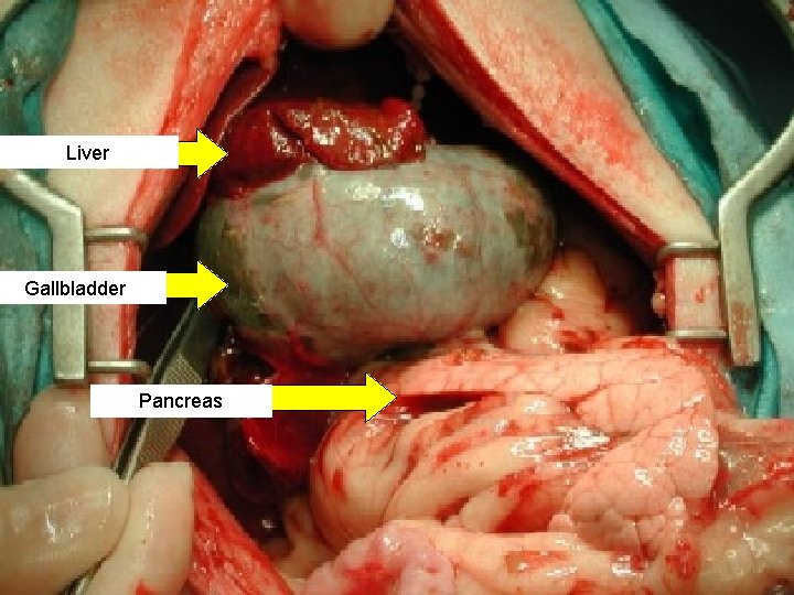 Liver Gallbladder Pancreas 