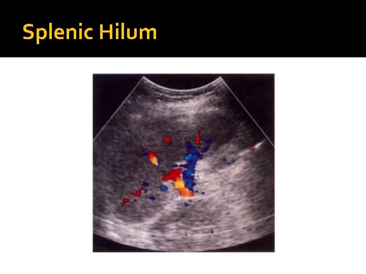 Splenic Hilum 