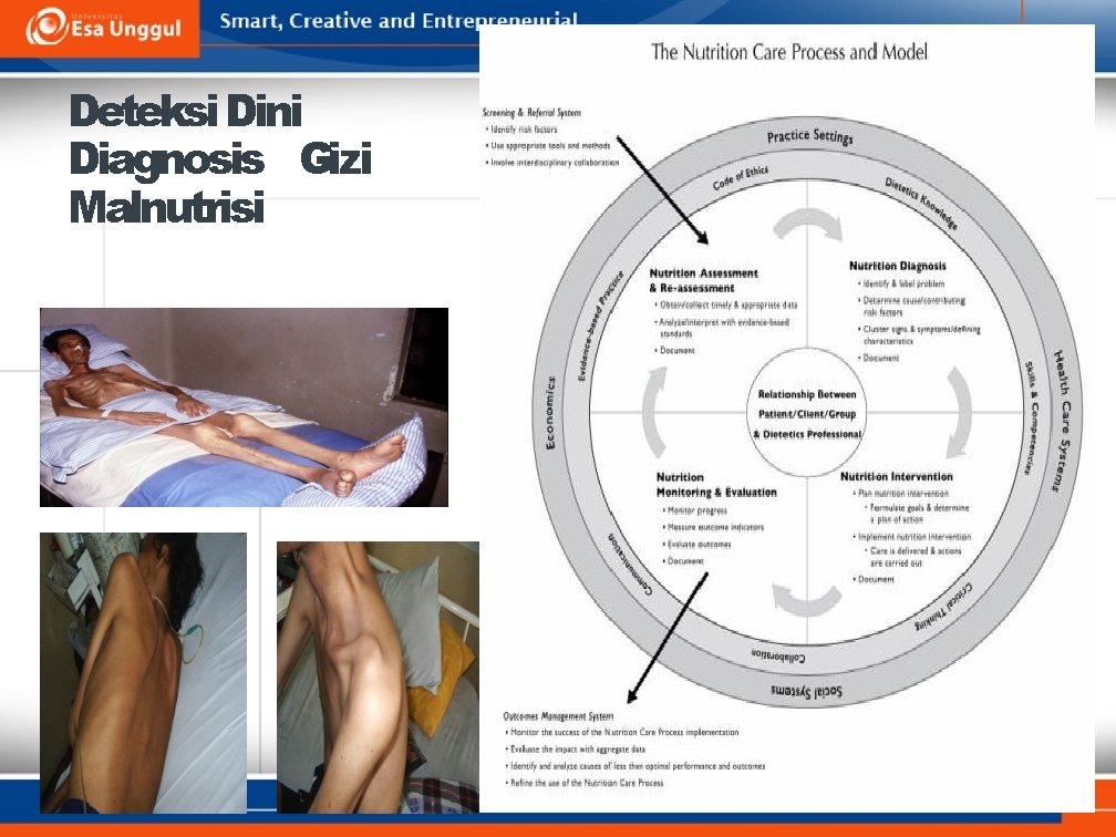 Deteksi Dini Diagnosis Gizi Malnutrisi 