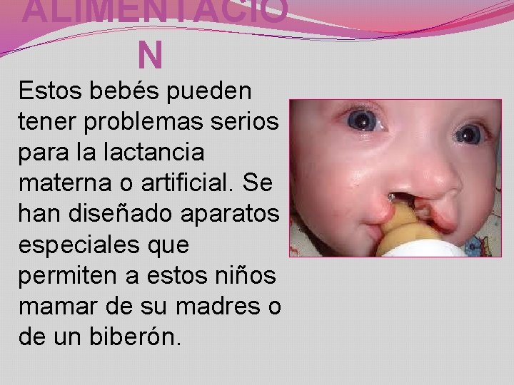 ALIMENTACIÓ N Estos bebés pueden tener problemas serios para la lactancia materna o artificial.
