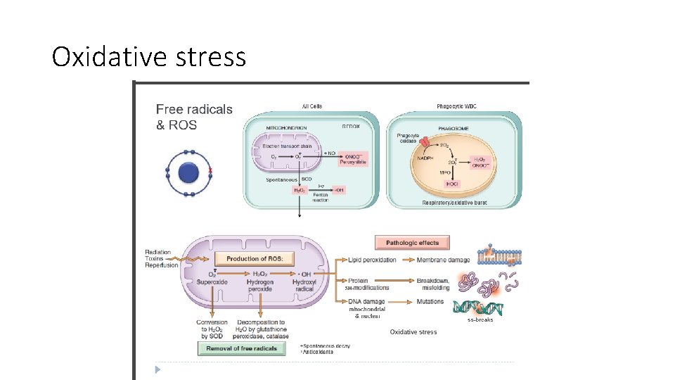 Oxidative stress 