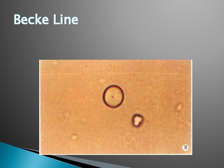 Becke Line 