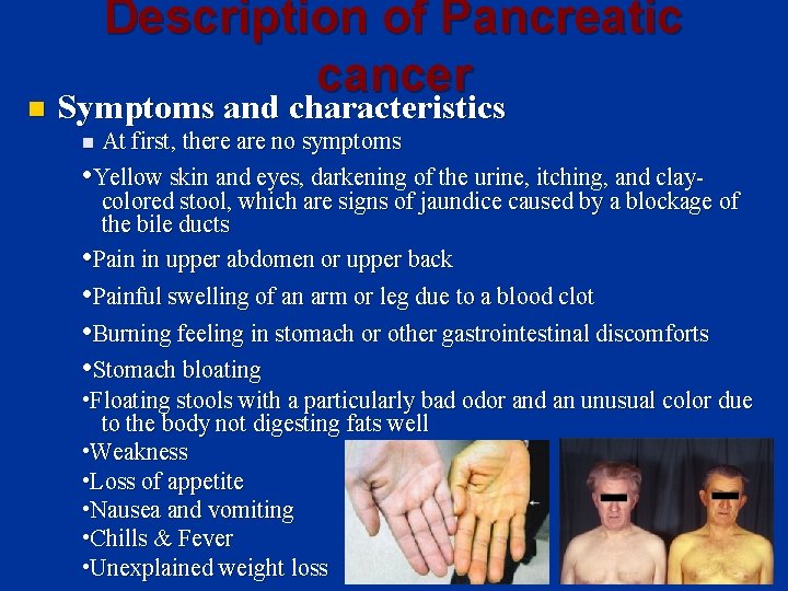 n Description of Pancreatic cancer Symptoms and characteristics At first, there are no symptoms