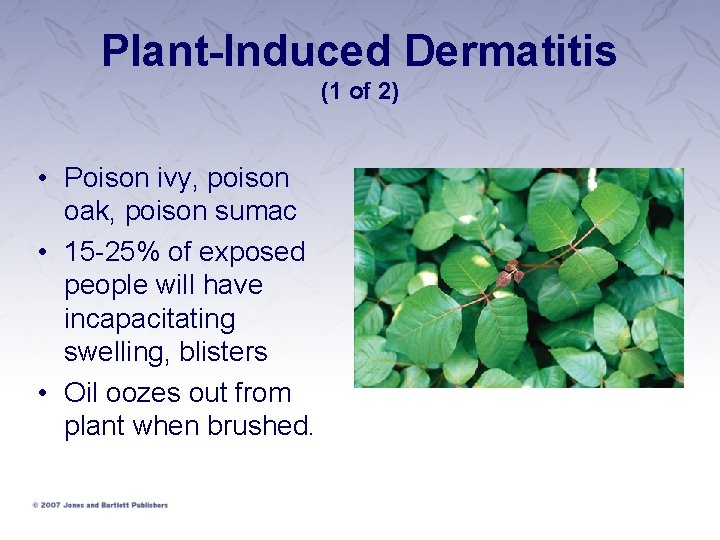 Plant-Induced Dermatitis (1 of 2) • Poison ivy, poison oak, poison sumac • 15 Plant-Induced Dermatitis (1 of 2) • Poison ivy, poison oak, poison sumac • 15
