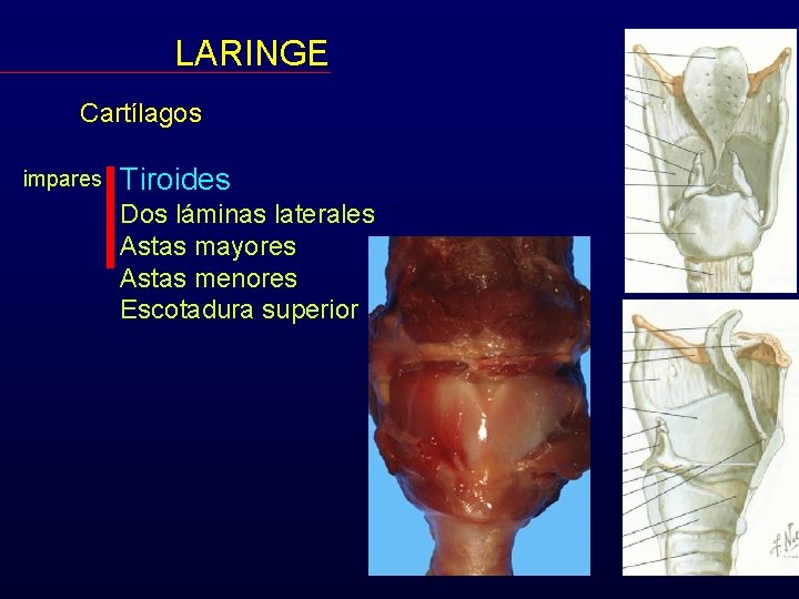 LARINGE Cartílagos impares Tiroides Dos láminas laterales Astas mayores Astas menores Escotadura superior 