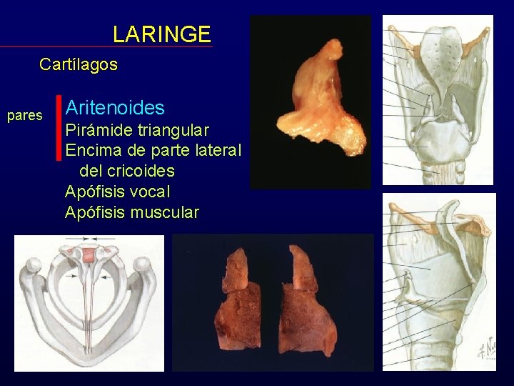 LARINGE Cartílagos pares Aritenoides Pirámide triangular Encima de parte lateral del cricoides Apófisis vocal