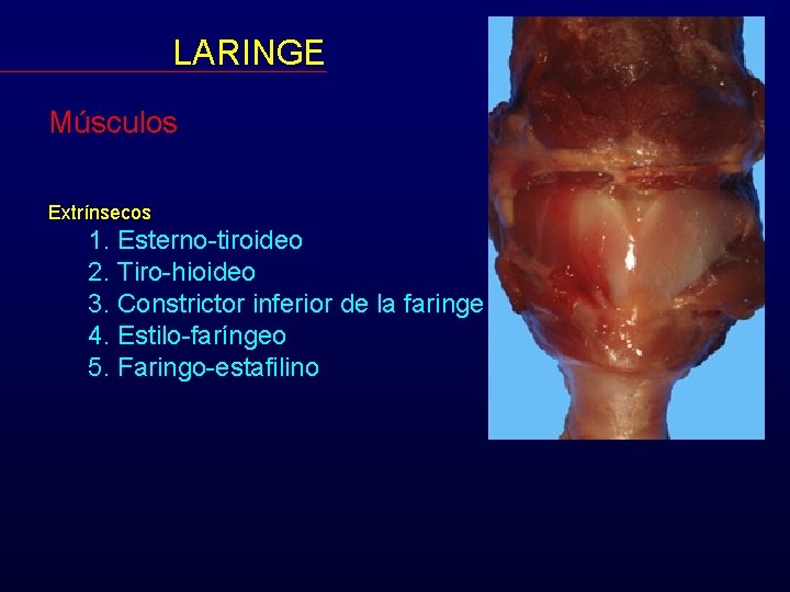 LARINGE Músculos Extrínsecos 1. Esterno-tiroideo 2. Tiro-hioideo 3. Constrictor inferior de la faringe 4.